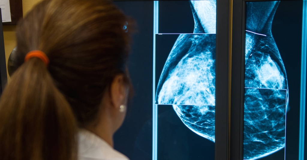 Ask about breast density