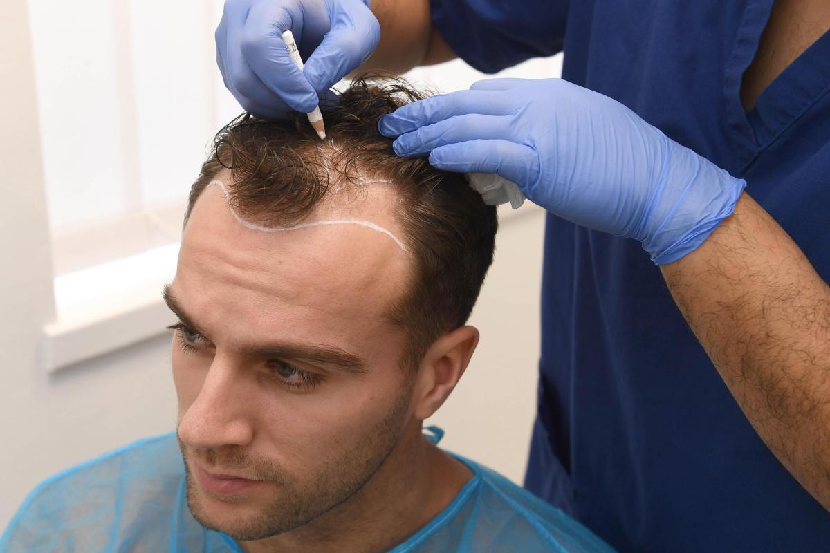 Blue Magic Hair Clinic Turkey - Hair Transplant in Istanbul - wide 6