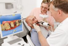 CEREC System